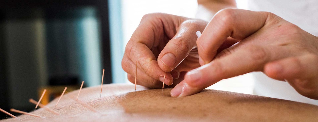 Acupuncture and Traditional Chinese Medicine (T.C.M.)